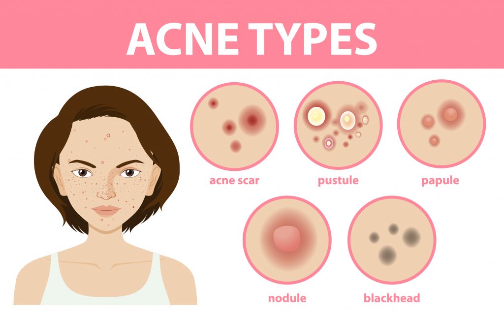 Types of acne on the ski